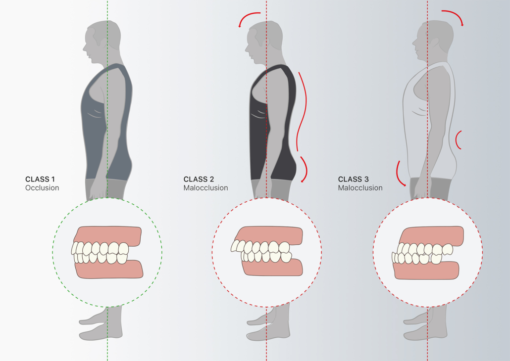 Malocclusioni dentali