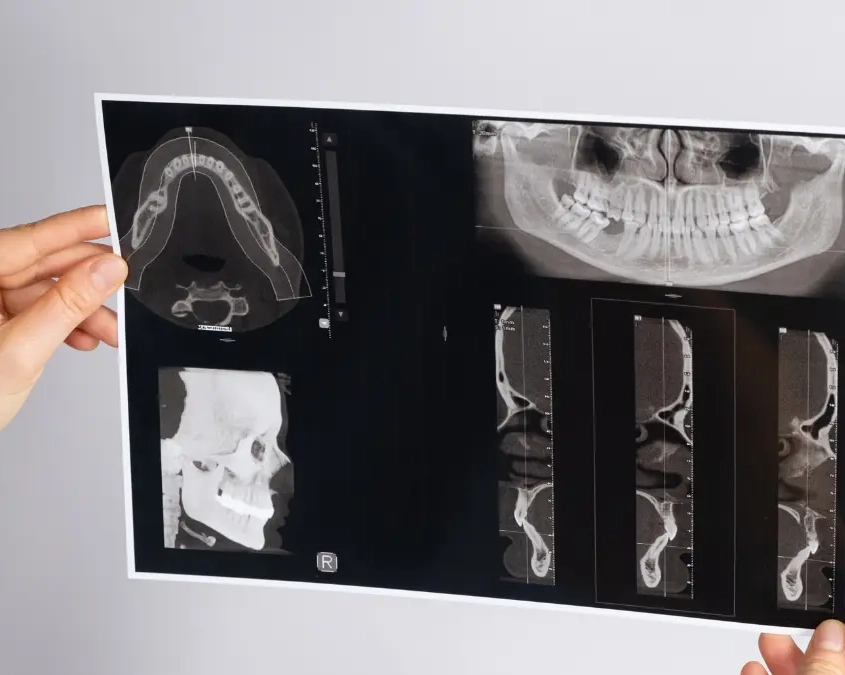 Malocclusione dentale e postura c’è un legame Malocclusione dentale e postura c'è un legame